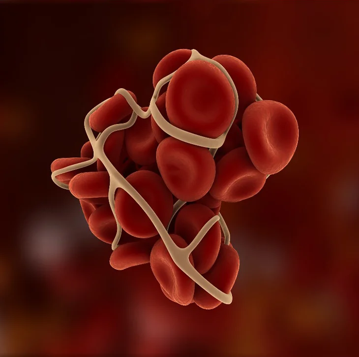 Case Study: Enhancing Care Transitions for Patients with Venous Thromboembolism (VTE)